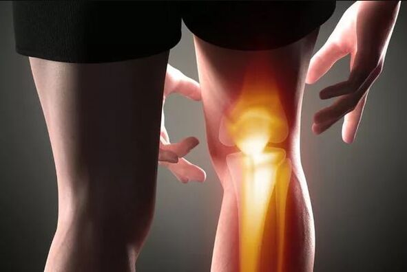 Arthrose de l'articulation du genou