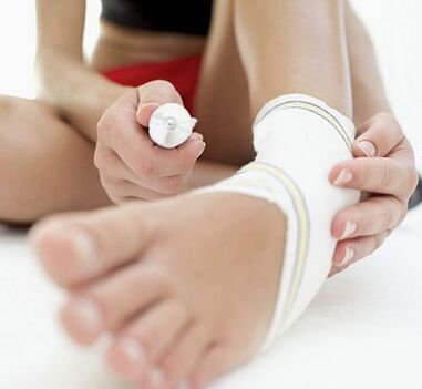 Liaison avec arthrose