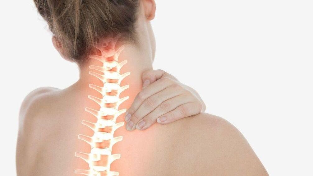 Avec l'ostéochondrose de la colonne cervicale, un syndrome radiculaire peut se développer