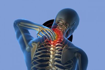 douleur dans le cou avec ostéochondrose